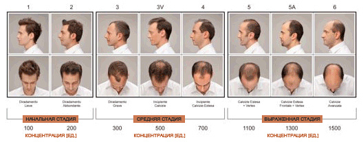 Labo Crescina: линия интенсивных косметических средств против выпадение волос и для стимуляции их роста. В нашем ассортименте представлены и мужские и женские ампулы. 